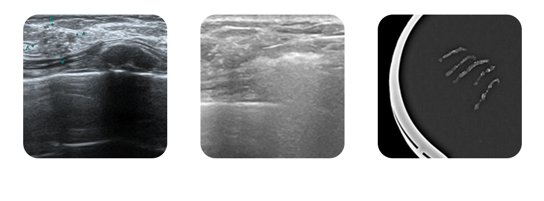 시술 사진