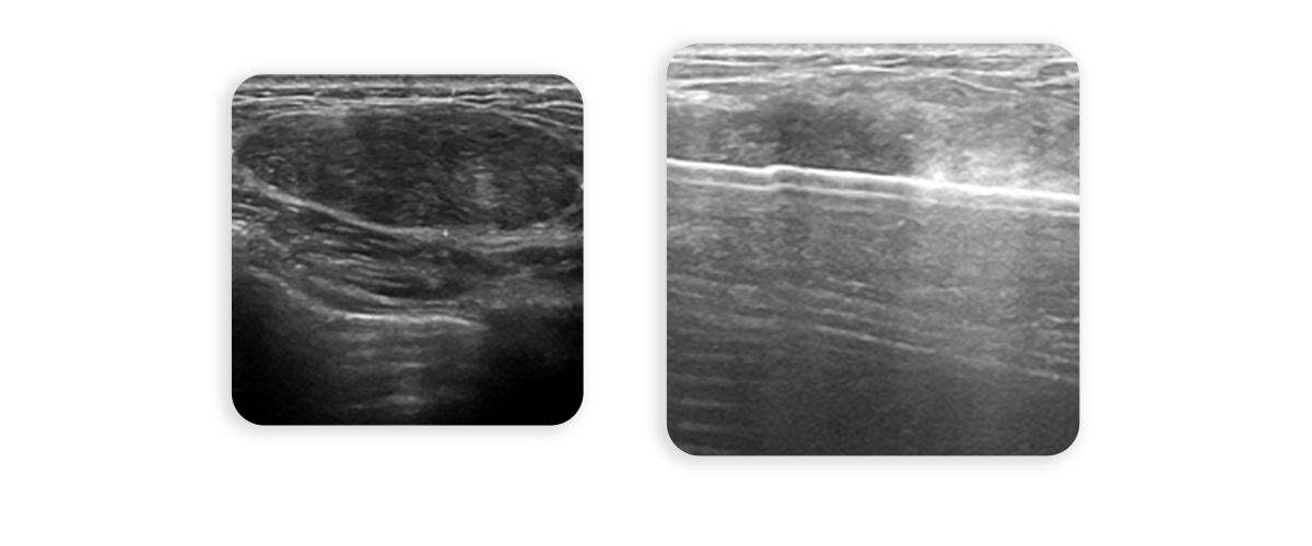 시술 사진